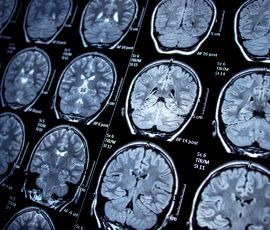 Neurology & Neurosurgery